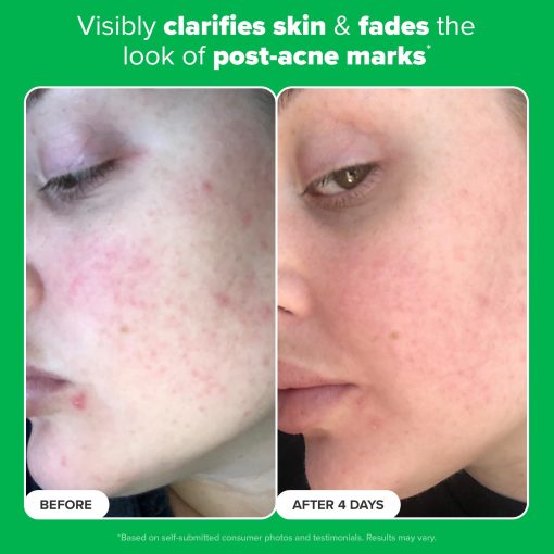 Paula's Choice BOOST 10% Azelaic Acid Booster Cream Gel Face Serum with Salicylic Acid, Oil-Free Skin Brightening Serum for Face, Fragrance-Free, 1oz - Image 6