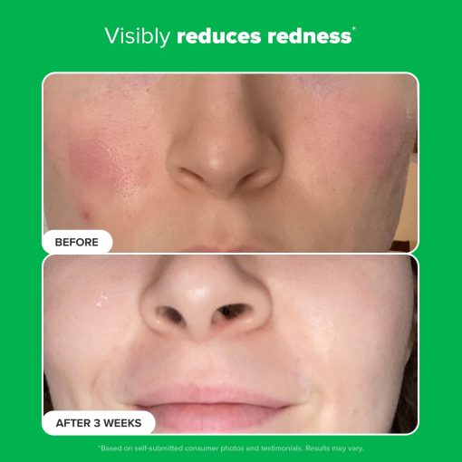 Paula's Choice BOOST 10% Azelaic Acid Booster Cream Gel Face Serum with Salicylic Acid, Oil-Free Skin Brightening Serum for Face, Fragrance-Free, 1oz - Image 5