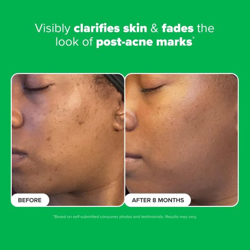 Paula's Choice BOOST 10% Azelaic Acid Booster Cream Gel Face Serum with Salicylic Acid, Oil-Free Skin Brightening Serum for Face, Fragrance-Free, 1oz - Image 7