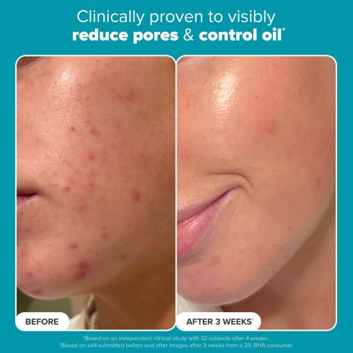 Paula's Choice Skin Perfecting 2% BHA Liquid Salicylic Acid Exfoliant, Gentle Facial Exfoliator for Blackheads, Large Pores, Wrinkles & Fine Lines, Travel Size, 1 Fluid Ounce - Image 7