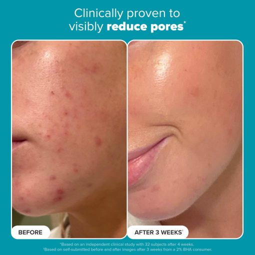 Paula's Choice SKIN PERFECTING 2% BHA Liquid Salicylic Acid Exfoliant-Facial Exfoliant for Enlarged Pores, Wrinkles & Fine Lines and Suitable for Blackhead-Prone Skin, 10 ct - Image 7