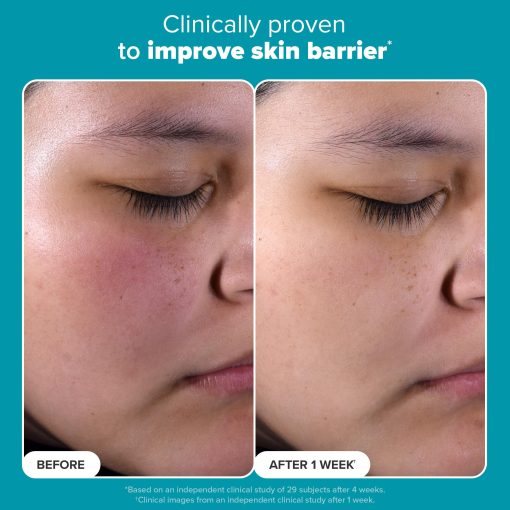 Paula's Choice SKIN PERFECTING 2% BHA Liquid Salicylic Acid Exfoliant-Facial Exfoliant for Enlarged Pores, Wrinkles & Fine Lines and Suitable for Blackhead-Prone Skin, 10 ct - Image 8