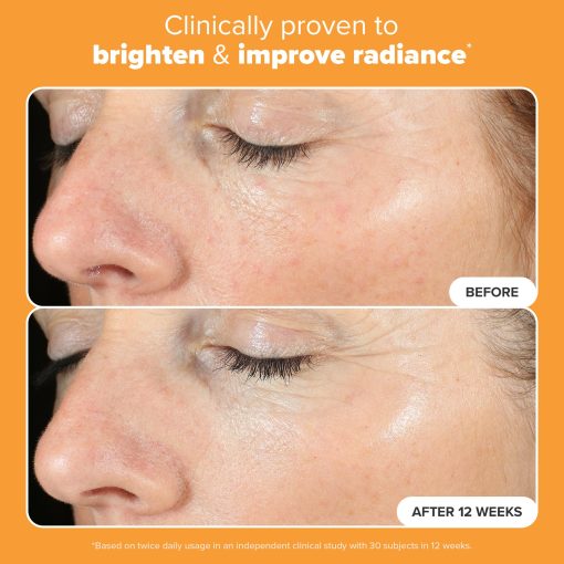 Paula's Choice BOOST C15 Super Booster, 15% Vitamin C Serum for Face, Face Serum with Vitamin E & Ferulic Acid for Discoloration & Glow, Fragrance-Free, 0.67 Fl Oz - Image 6